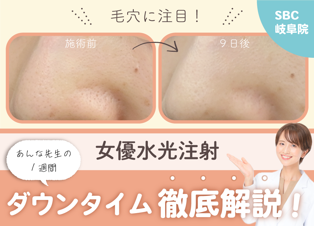 女優水光注射ダウンタイム徹底解説！